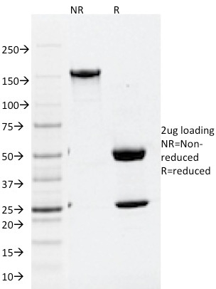 Data from SDS-PAGE analysis of Anti-ATG5 antibody (Clone ATG5/2101). Reducing lane (R) shows heavy and light chain fragments. NR lane shows intact antibody with expected MW of approximately 150 kDa. The data are consistent with a high purity, intact mAb.